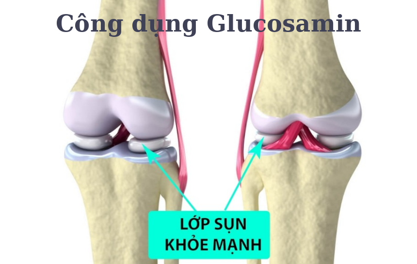 Sử dụng glucosamin rất tốt cho xương khớp